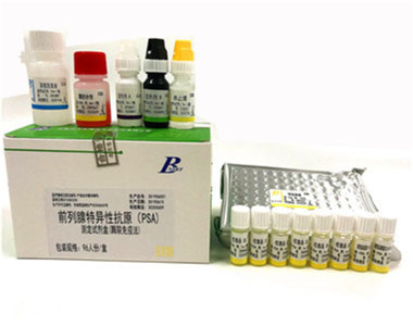 北方 前列腺特异性抗原（PSA）测定试剂盒（酶联免疫法）